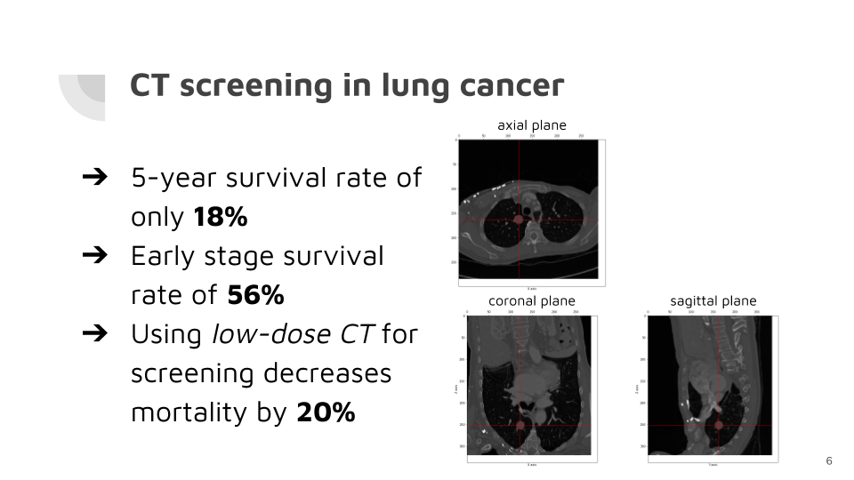 Usage of CT screening in lung cancer
