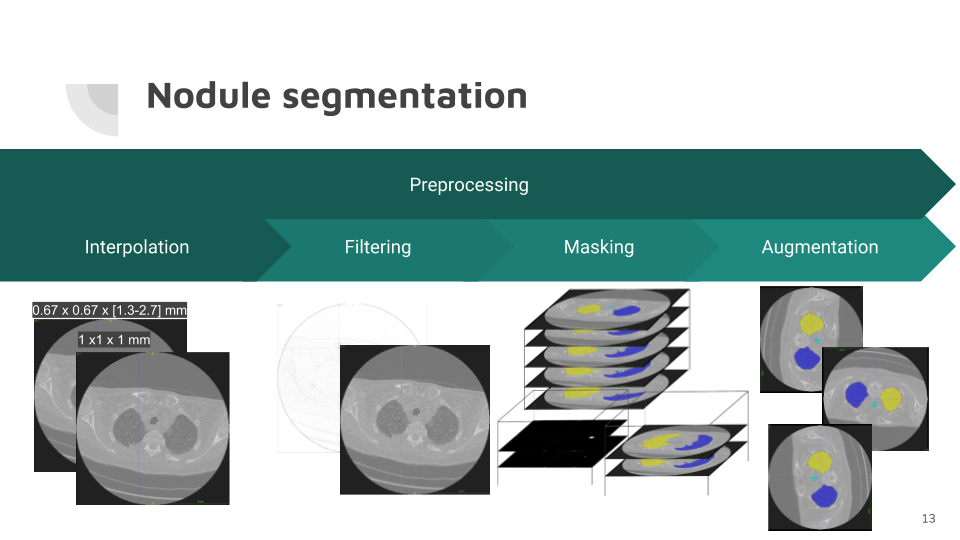 lucanode nodule segmentation